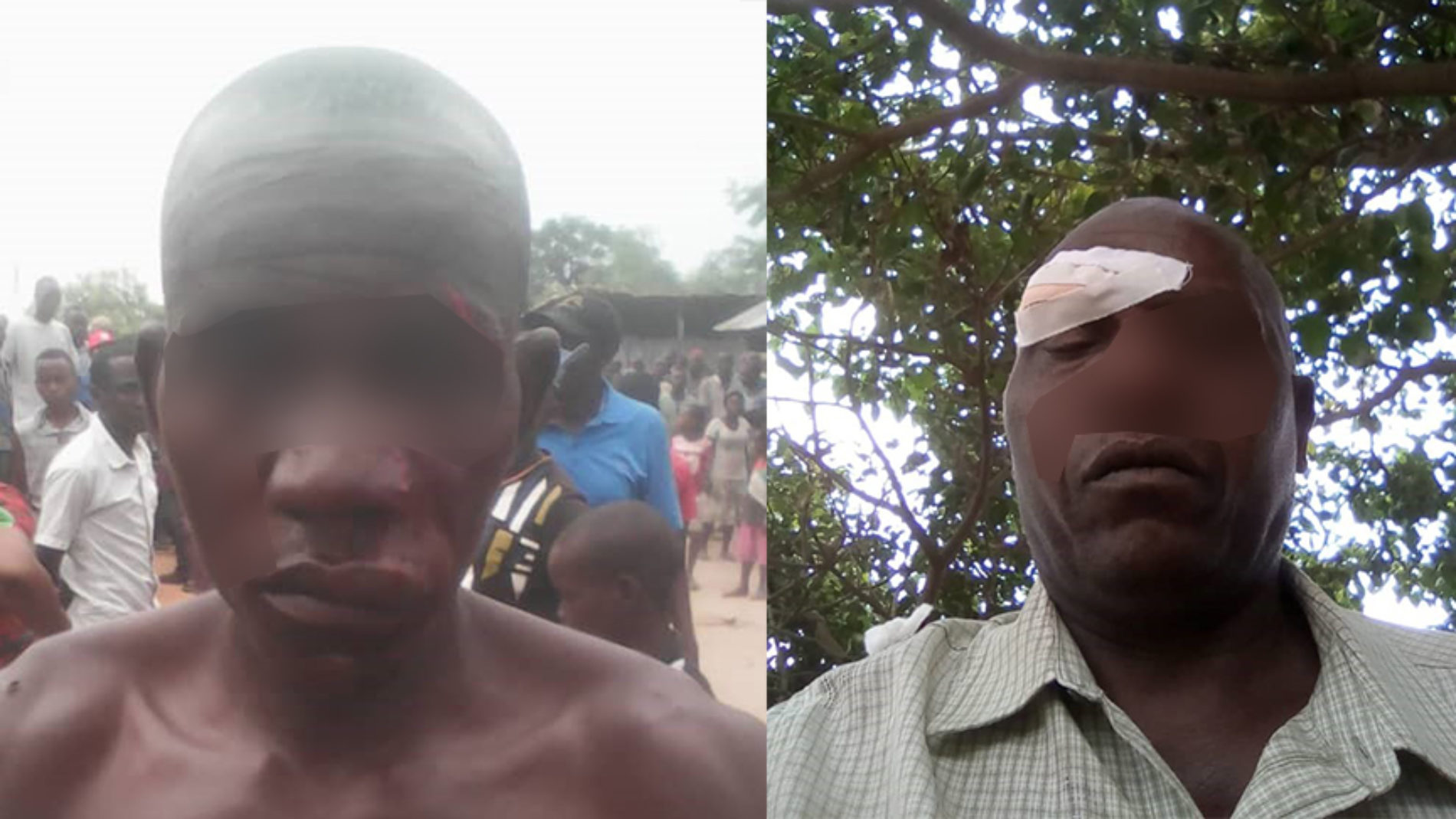 Bubanza : Des échauffourées entre militants du CNL et du CNDD FDD font deux blessés à Buringa