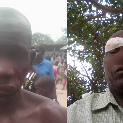 Bubanza : Des échauffourées entre militants du CNL et du CNDD FDD font deux blessés à Buringa