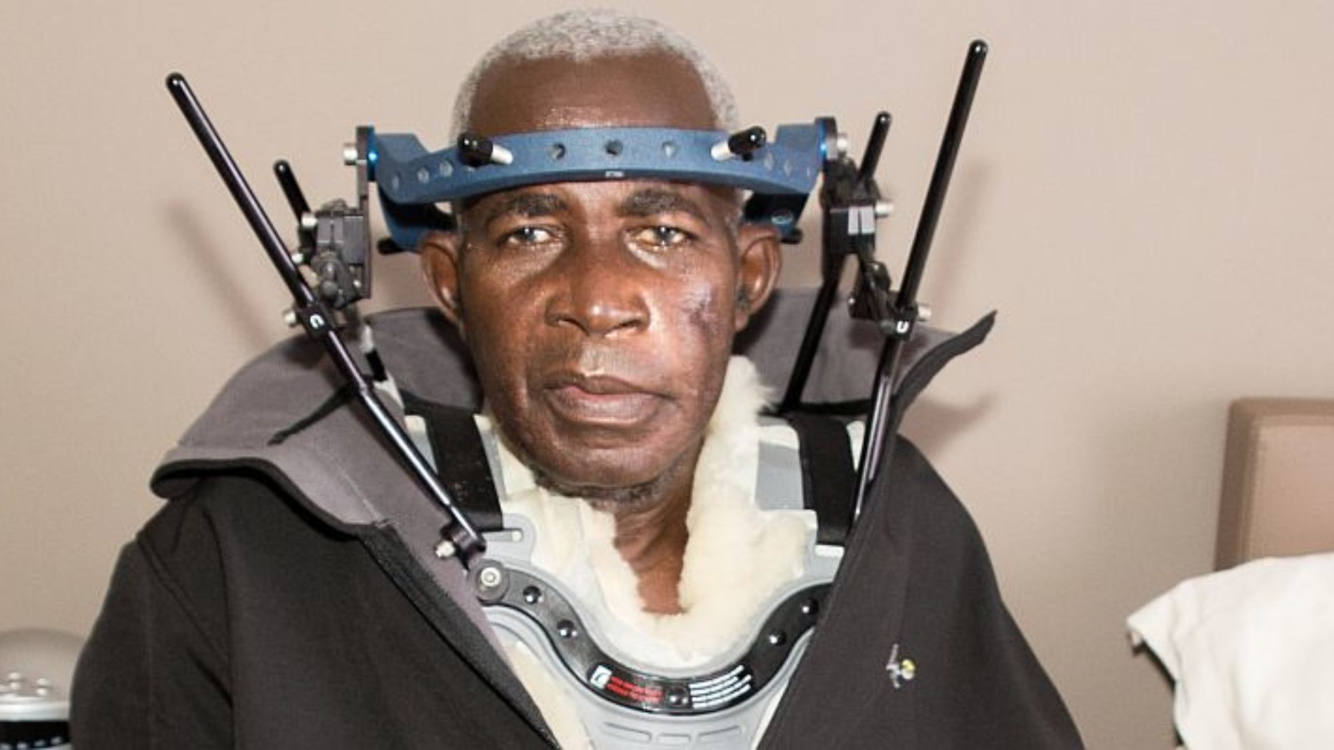 Quatre ans après la tentative d’assassinat contre Pierre Claver Mbonimpa, la CBDDH réclame des enquêtes abouties