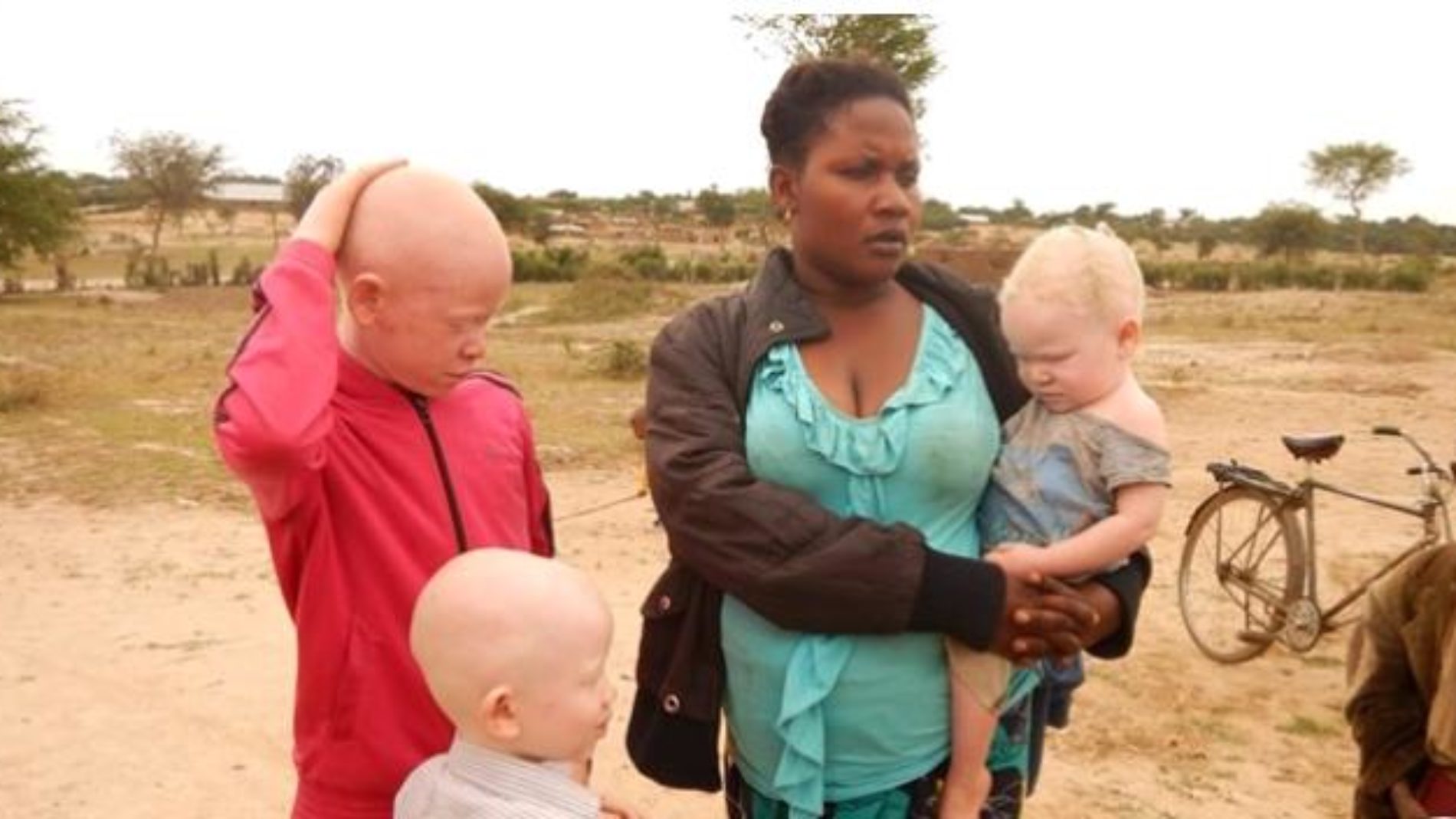 IMAGE de la semaine : les réfugiés burundais  albinos demandent  une assistance particulière