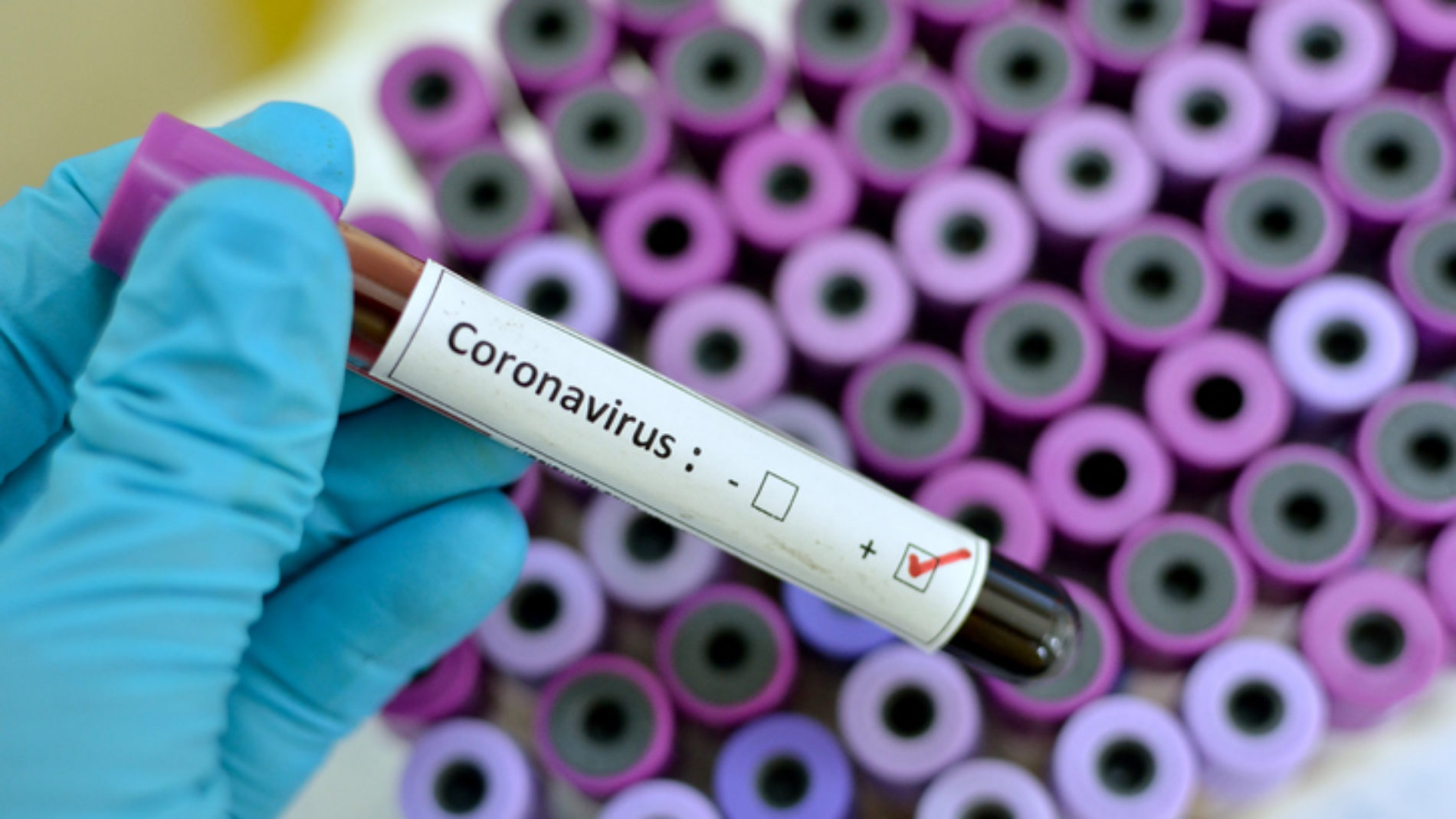 Covid-19: le Burundi annonce 40 nouveaux cas de Coronavirus