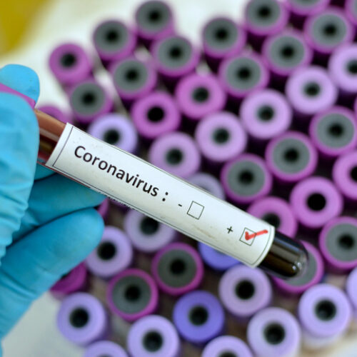 Covid-19: le Burundi annonce 40 nouveaux cas de Coronavirus