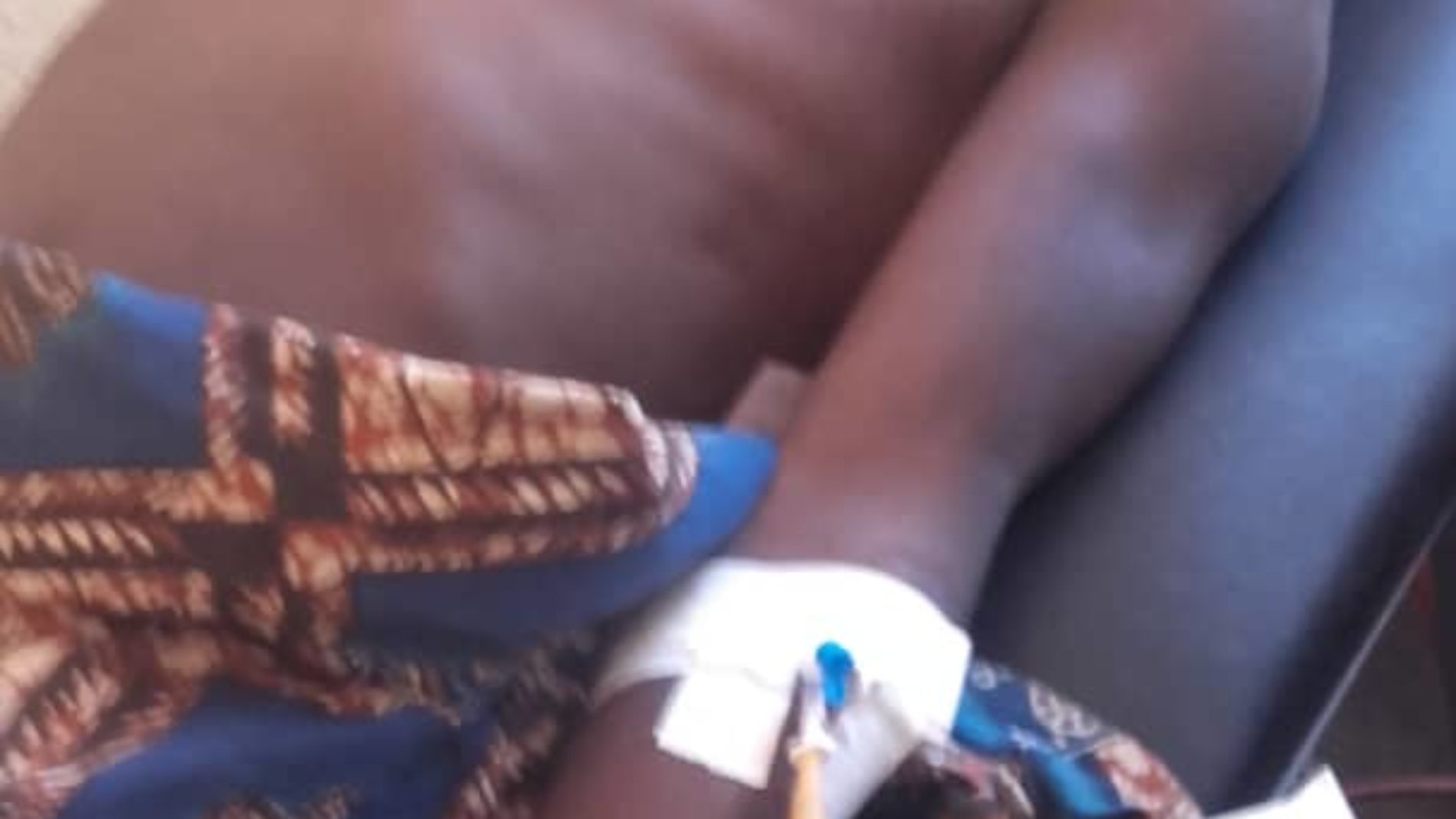 Rumonge : Un opposant grièvement blessé au bras, ses agresseurs relâchés