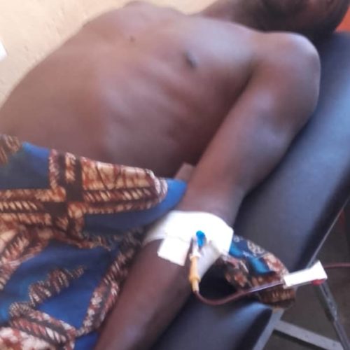 Rumonge : Un opposant grièvement blessé au bras, ses agresseurs relâchés