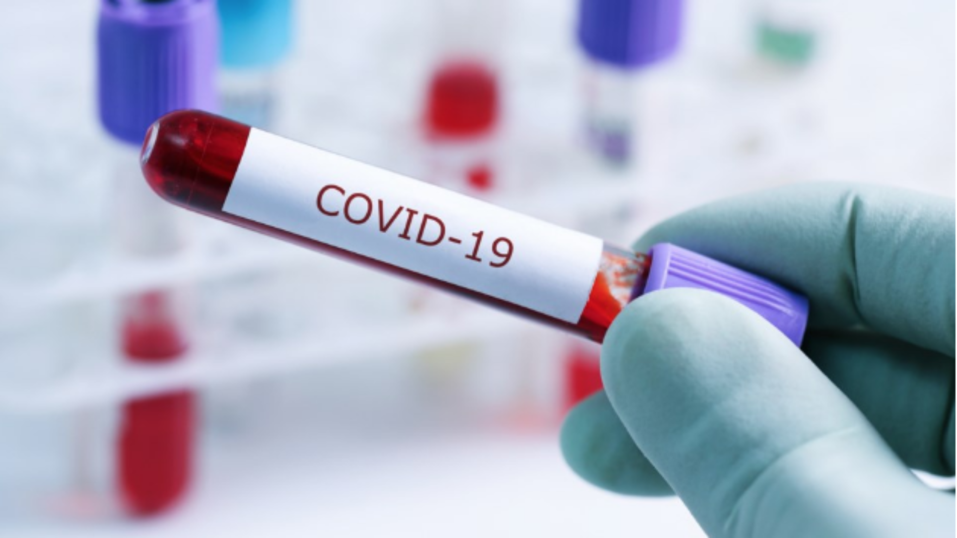 Nakivale  : un premier cas de Covid-19 confirmé, des mises en quarantaine