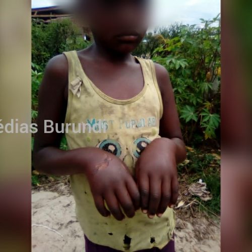 Gihanga : un chef de colline et membre de la ligue des Imbonerakure brûle une fillette, des habitants exigent qu&rsquo;il soit puni