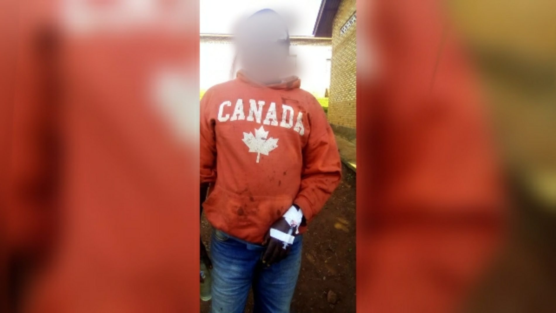 Busiga : des Imbonerakure ont blessé un opposant