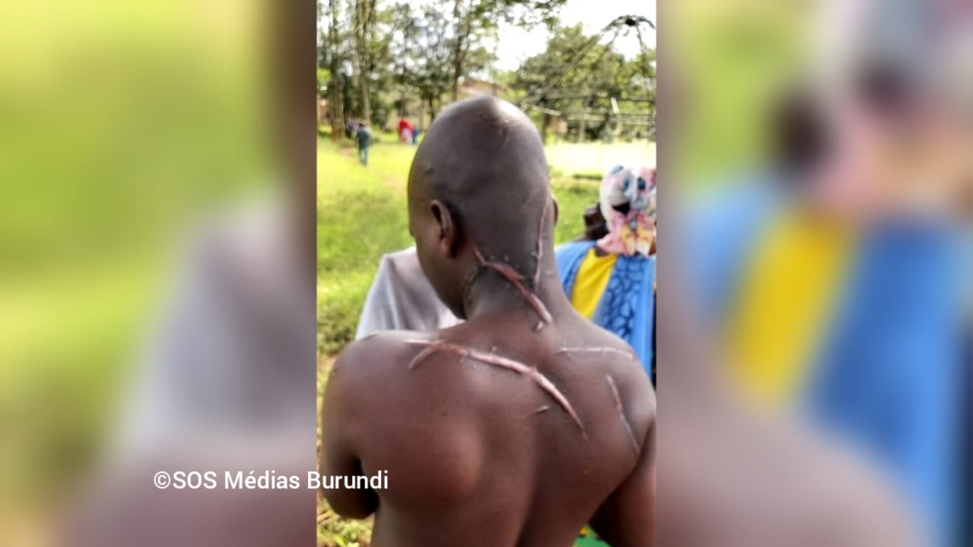 Cibitoke : des Imbonerakure blessent un habitant, le parquet les relâche et la population se révolte