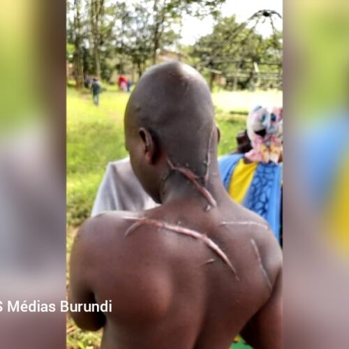 Cibitoke : des Imbonerakure blessent un habitant, le parquet les relâche et la population se révolte