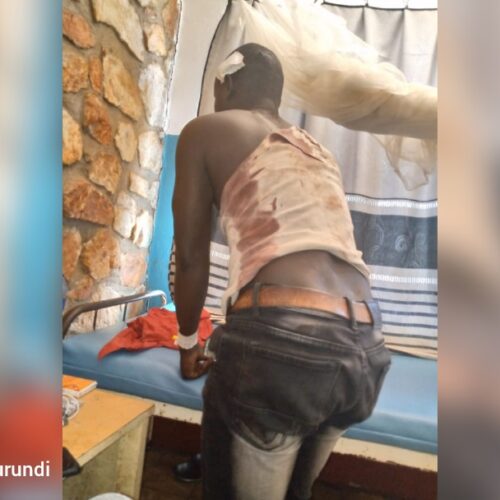 Bubanza : un agent du SNR dénonce la fraude de carburant, il est sérieusement tabassé jusqu’à être admis à l’hôpital