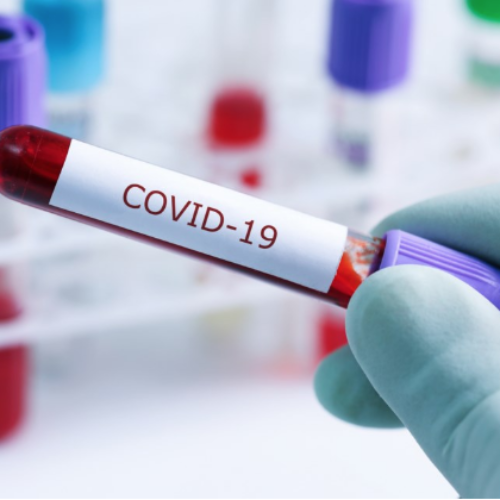 Bururi : more than 90 cases of Covid-19 detected in boarding schools