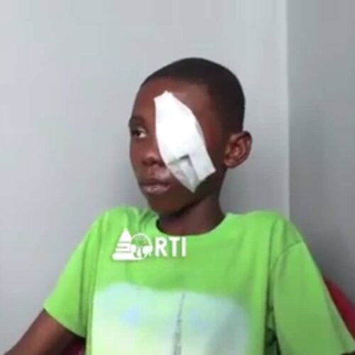 Bujumbura: a student loses his left eye in a caning session