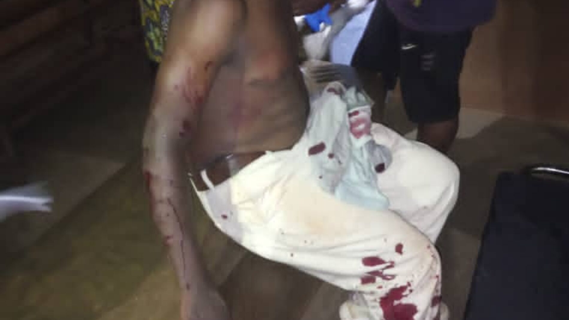 Dzaleka : une explosion de grenade a fait 15 blessés