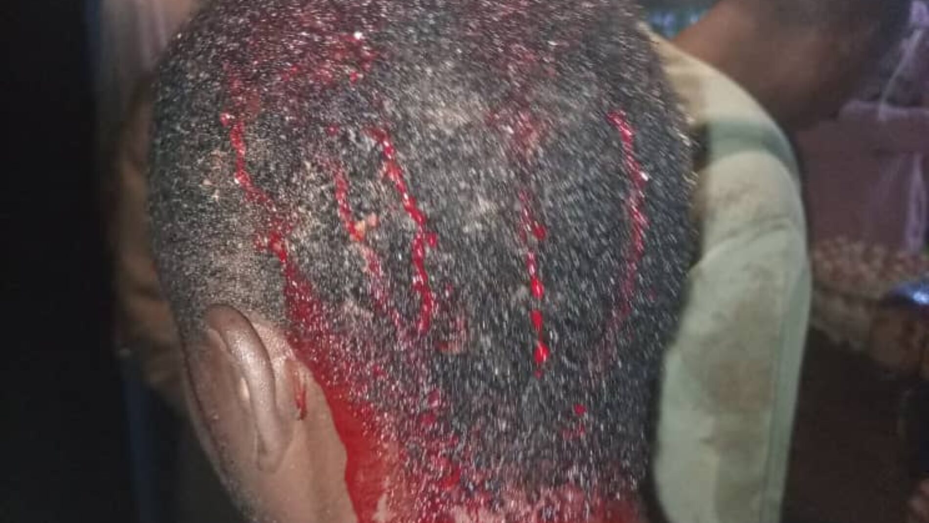 Dzaleka (Malawi) : un réfugié burundais agressé à la machette