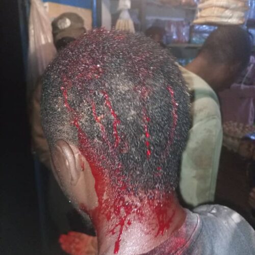 Dzaleka (Malawi) : un réfugié burundais agressé à la machette