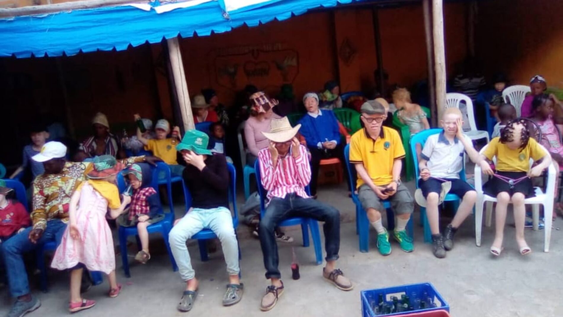 Photo de la semaine: le cancer de la peau, une menace pour les albinos du camp de Nakivale