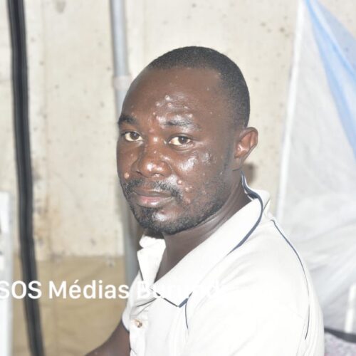 Goma: karibu vifo thelathini na zaidi ya watu 3,800 walioathiriwa na janga la tumbili huko Kivu Kaskazini.