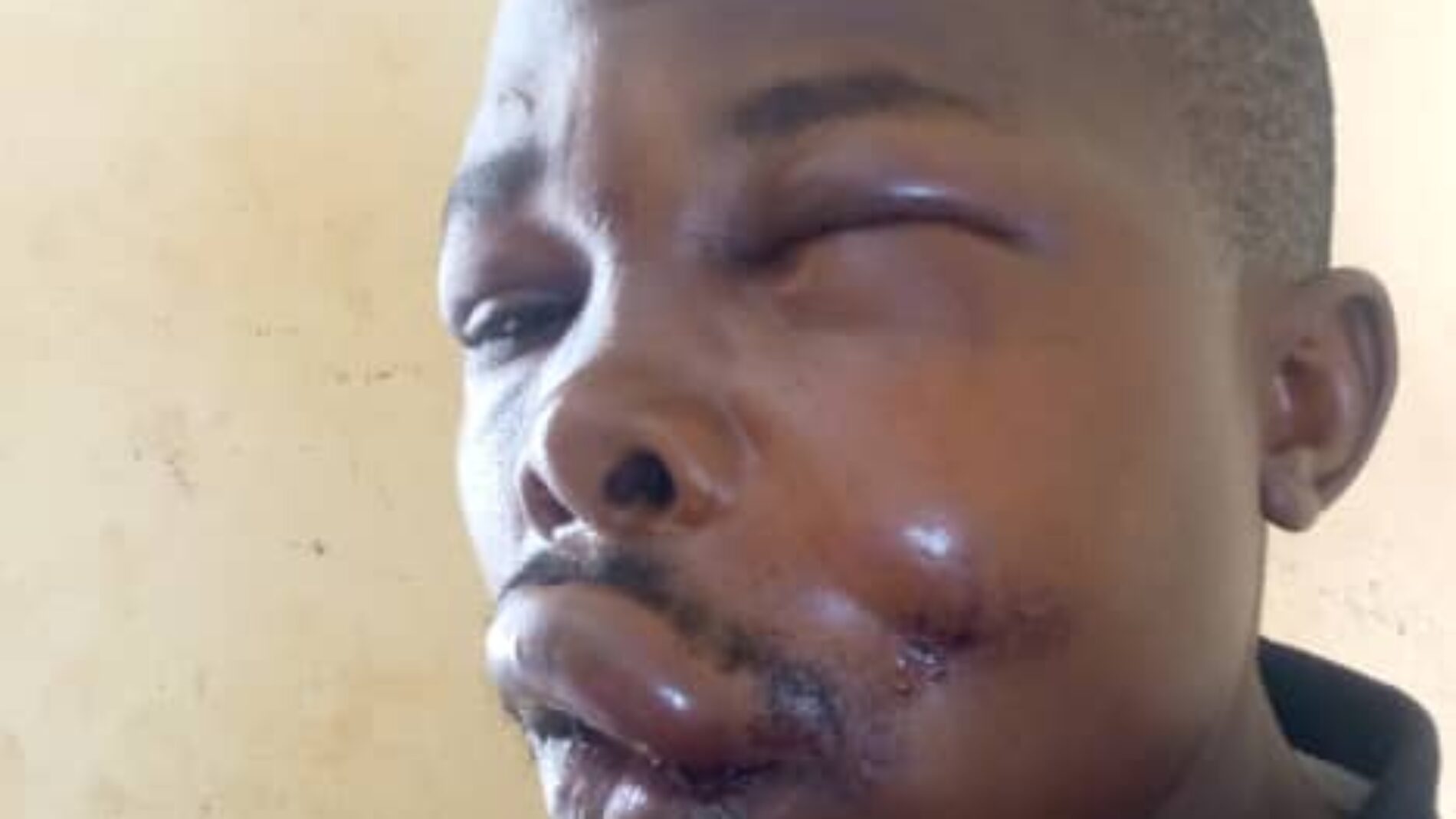 Cibitoke : a police officer shot a resident at point-blank range, seriously injuring him