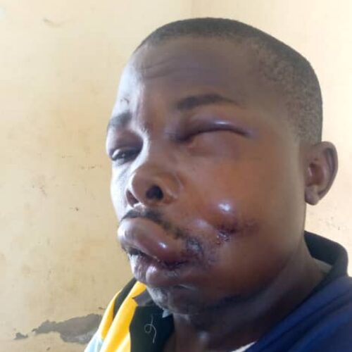 Cibitoke : un policier a tiré sur un habitant à bout portant, le blessant grièvement