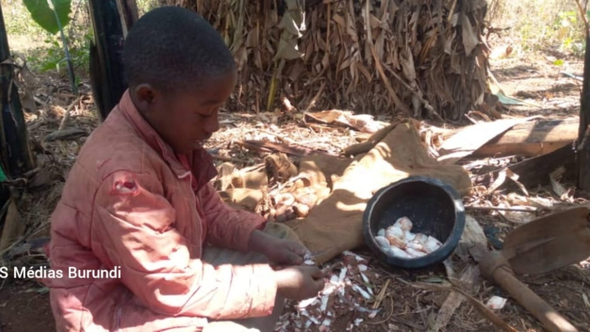 Kakuma (Kenya): watoto kadhaa waliotishwa na Kwashiorkor