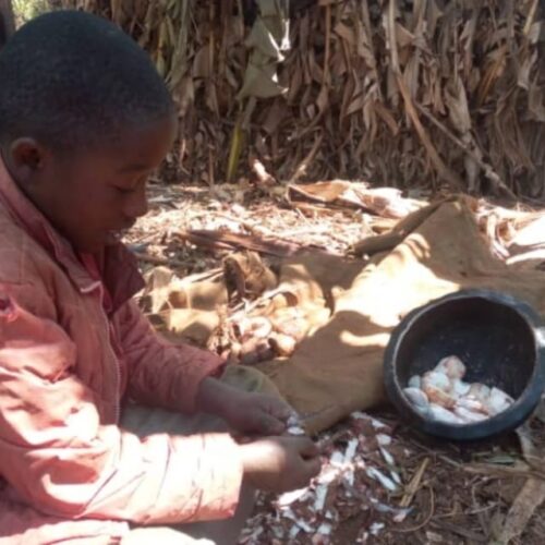 Kakuma (Kenya) : several children threatened by Kwashiorkor
