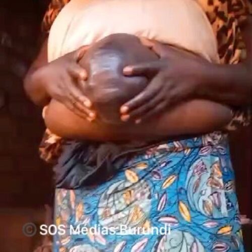 Nyarugusu (Tanzania) : an SOS for a Burundian refugee who needs an emergency operation