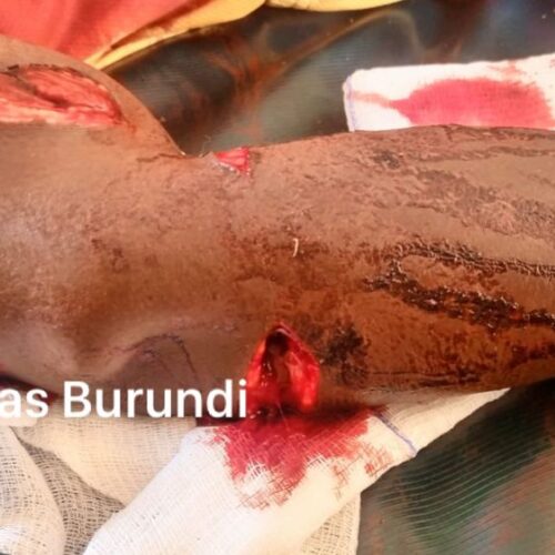 Kakuma (Kenya) : un réfugié burundais agressé