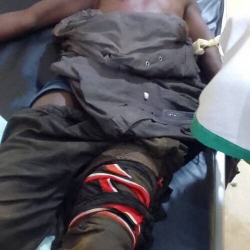 Gitega: wanandoa wawili wamefungwa huko Giheta kwa jaribio la mauaji