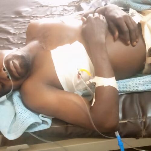 Malawi: Mkimbizi wa Burundi apigwa karibu kufa kutokana na homa ya uchaguzi
