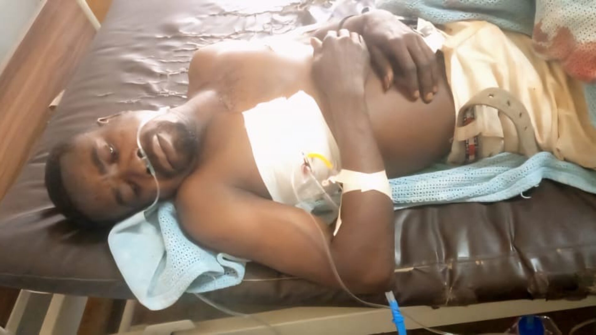 Malawi : a Burundian refugee beaten nearly to death amid election fever