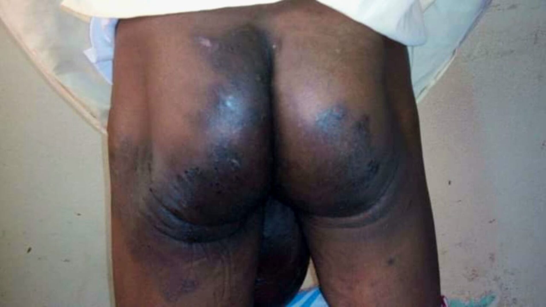 Burundi: Vifo 407, wafungwa 13,000, na ukiukwaji 663 uliorekodiwa katika mwaka mmoja, waonya Ligue Iteka