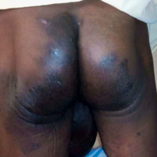 Burundi: Vifo 407, wafungwa 13,000, na ukiukwaji 663 uliorekodiwa katika mwaka mmoja, waonya Ligue Iteka