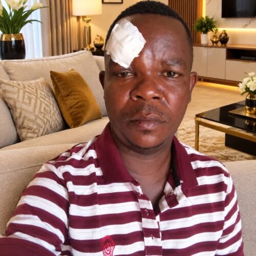 Bujumbura : le journaliste Kenny Claude Nduwimana violemment agressé près de son domicile