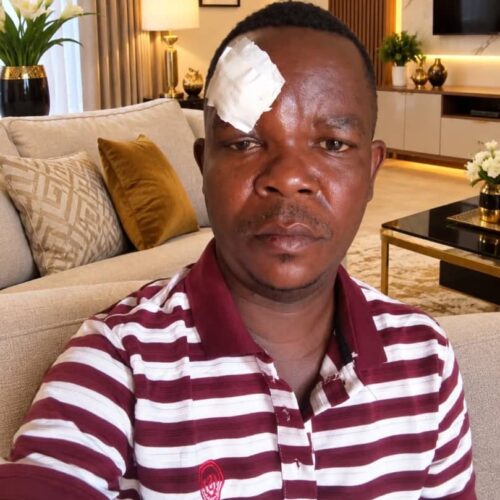 Bujumbura: Mwandishi wa habari Kenny Claude Nduwimana ashambuliwa kikatili karibu na nyumbani kwake